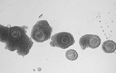 미성숙난자 체외 성숙 기법 (In Vitro Maturation, IVM)