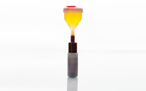 자궁내 혈소판풍부혈장 주입술 (Platelet Rich Plasma Injection)