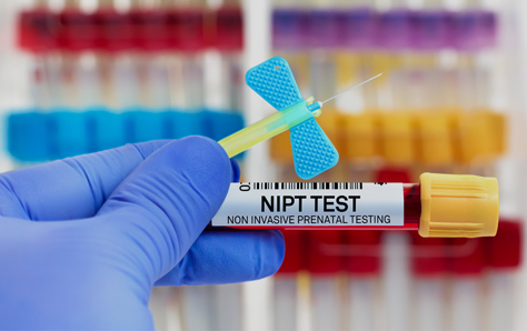 임신 초기 비침습적 산전 검사 (Non-Invasive Prenatal Testing, NIPT)
